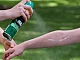 10 meilleurs remèdes après une piqûre de moustique