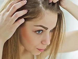 20 meilleurs remèdes antipelliculaires