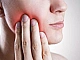 10 meilleures pilules contre les maux de dents