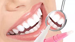 10 meilleurs blanchisseurs de dents d'Aliexpress