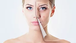 10 meilleures crèmes pour les peaux à problèmes