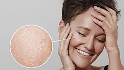 20 meilleures crèmes pour peau grasse