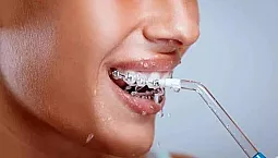 20 meilleurs irrigateurs