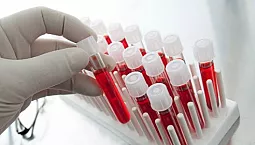 10 meilleurs laboratoires d'analyse à Moscou