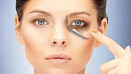 15 meilleurs remèdes contre les ecchymoses sous les yeux