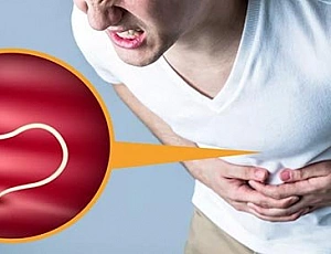 Top 20 des remèdes contre les parasites