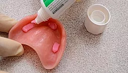 10 meilleures crèmes pour prothèses dentaires