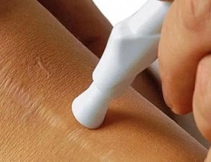 15 meilleurs remèdes pour les cicatrices et les cicatrices