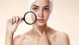 Top 10 des remèdes contre le rétrécissement des pores