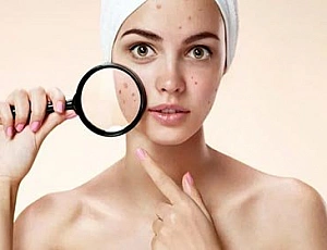 Top 10 des remèdes contre le rétrécissement des pores