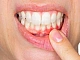 10 meilleurs dentifrices pour la parodontite et les maladies parodontales