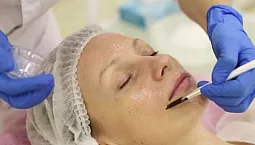 10 meilleurs peelings professionnels pour le visage