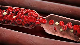 Top 10 des anticoagulants