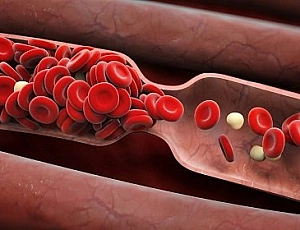 Top 10 des anticoagulants