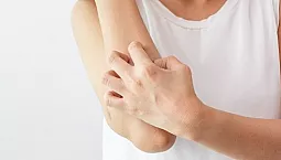 10 meilleurs remèdes contre les démangeaisons de la peau
