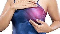 10 meilleures vitamines pour la mastopathie