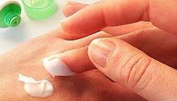 20 meilleures crèmes et onguents pour les allergies