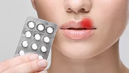 10 pilules les plus efficaces contre l'herpès