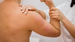 Top 10 des cliniques de traitement du psoriasis à Moscou