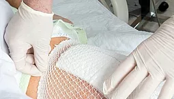 10 meilleurs onguents pour les escarres chez les patients alités