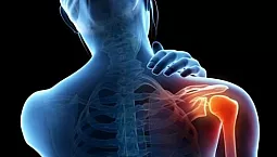 15 meilleurs onguents pour les articulations