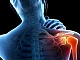 15 meilleurs onguents pour les articulations