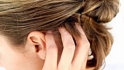 10 meilleurs shampooings pour le psoriasis sur la tête