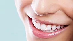 Top 10 des produits de blanchiment des dents