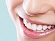 Top 10 des produits de blanchiment des dents
