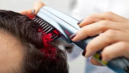 5 meilleurs peignes laser pour la perte de cheveux