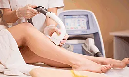 5 meilleures cliniques d'épilation au laser à Ekaterinbourg